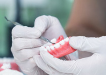 セラミック治療